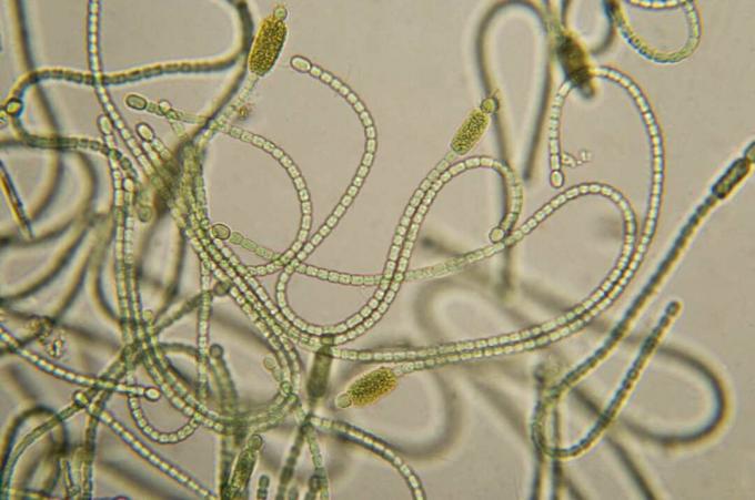 micrografie cianobacteria