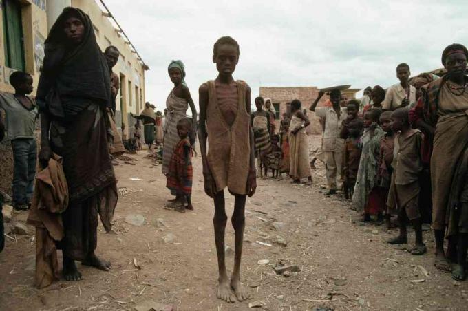 Victimele foametei rezultate în urma războiului civil din Somalia.