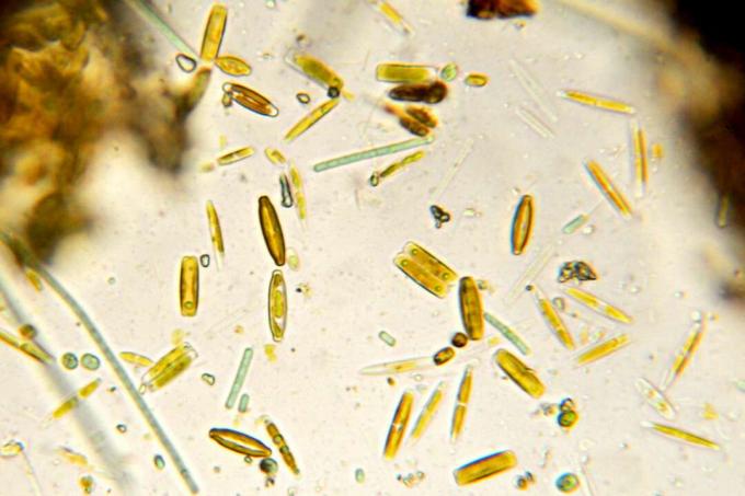 Diatomee, într-o varietate de forme, pe o lamelă la microscop